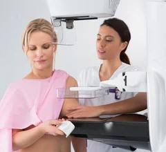 Mammogram breast imaging GE Patient with Pristina Dueta.
