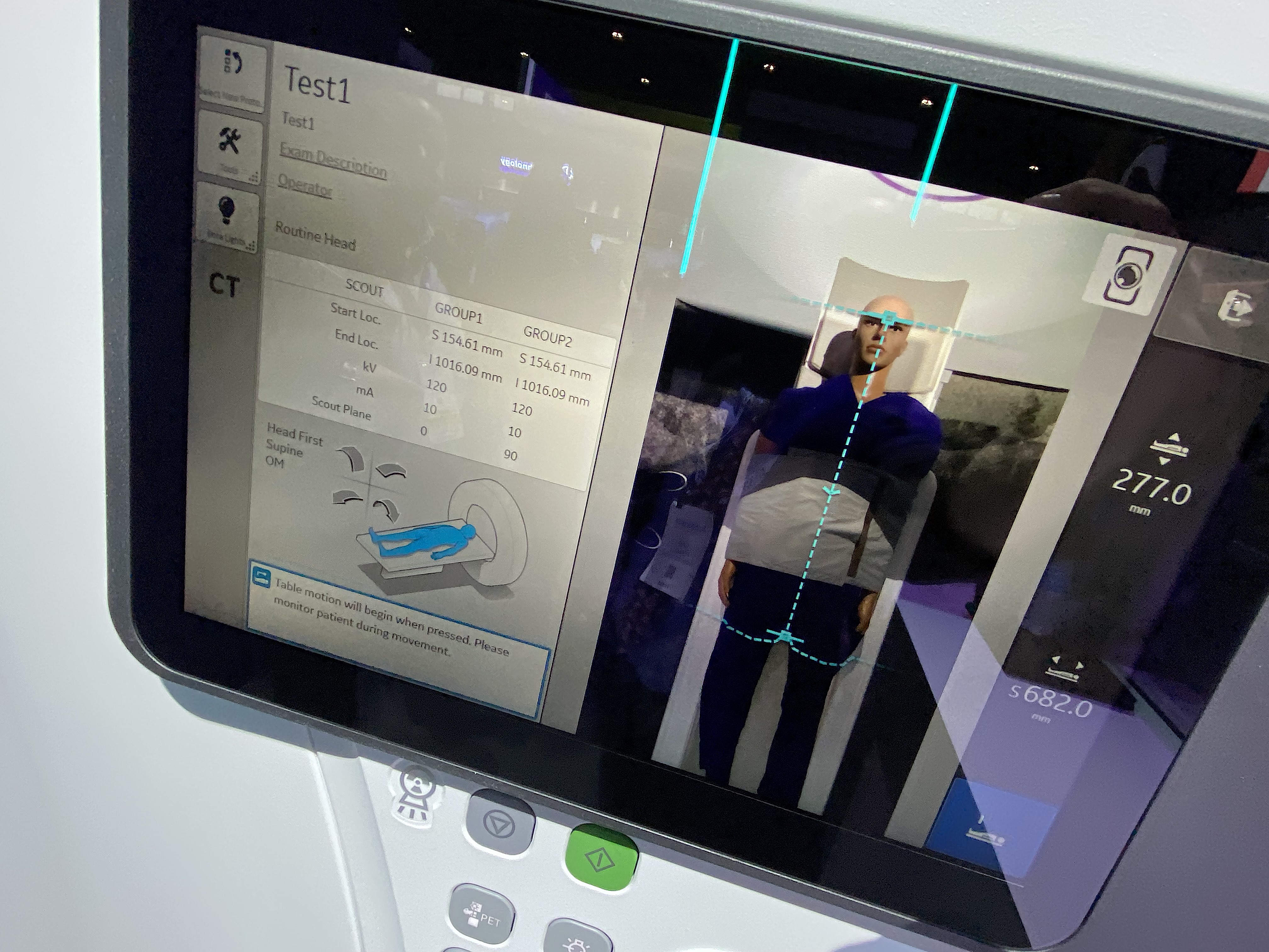PHOTO GALLERY: Examples of FDA-cleared AI in radiology