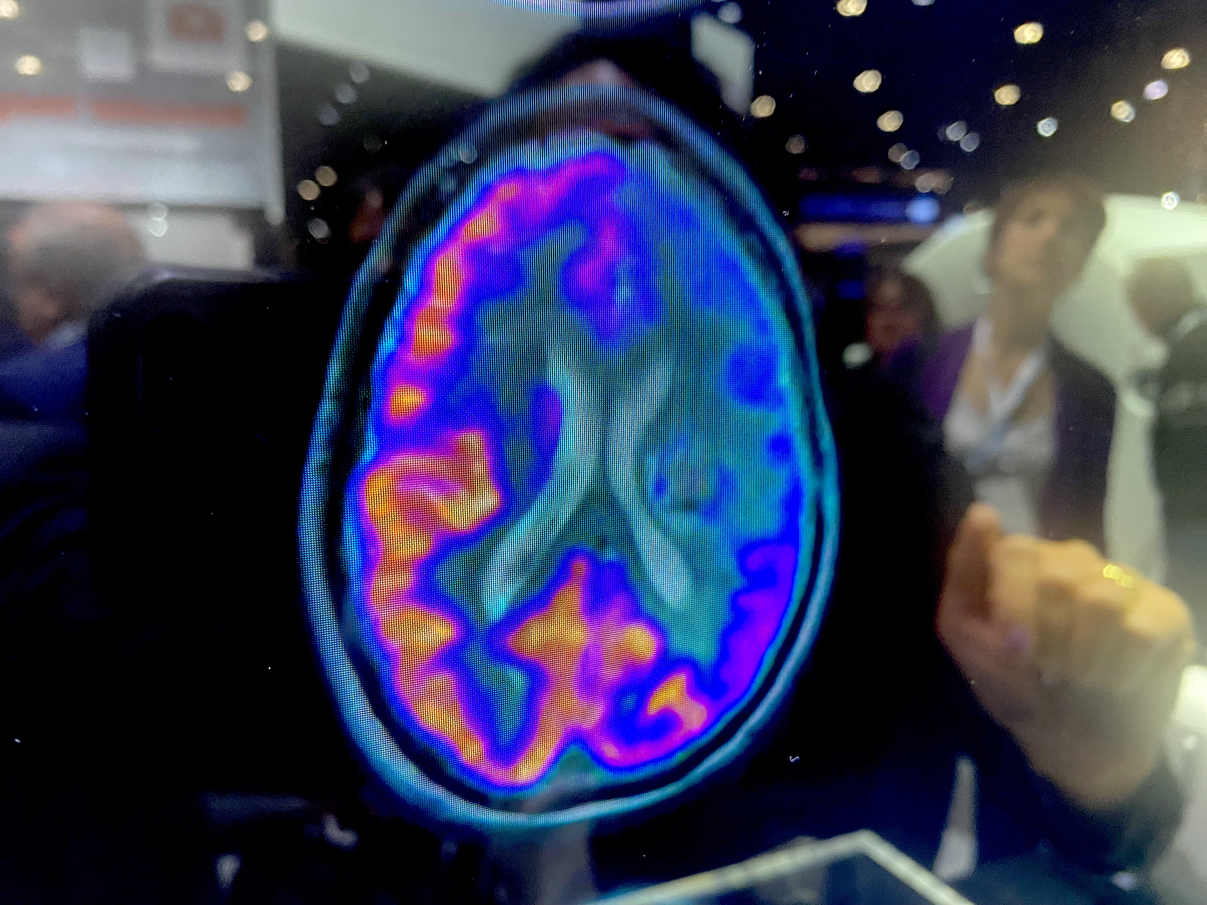 PHOTO GALLERY of brain imaging