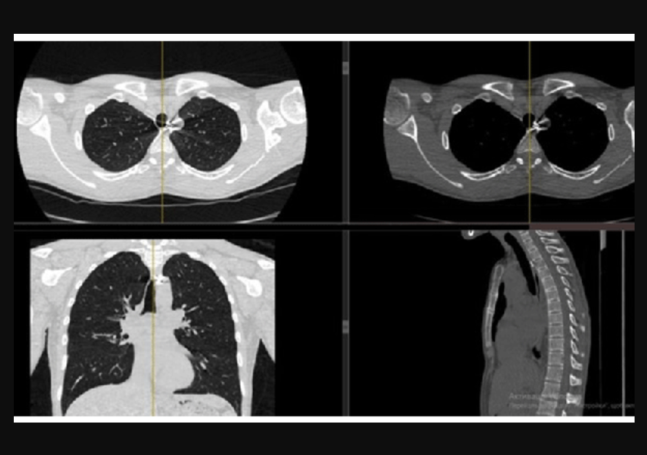 PHOTO GALLERY: Radiology images of Ukrainian trauma patients wounded in war