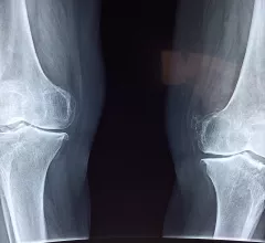 knee x-ray