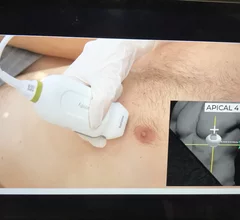 Novice medical professionals perform diagnostic quality echocardiograms with AI guidance