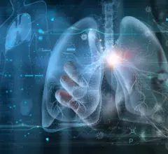 radiology trends lungs imaging graphs