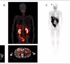 SNMMI Image of the Year