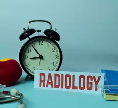 radiology clock alarm turnaround time efficiency