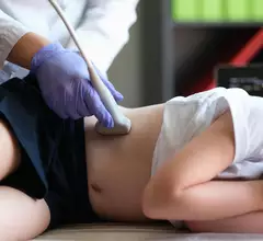 Renal ultrasound in pediatrics 