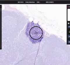 Paige Breast Lymph Node Screenshot