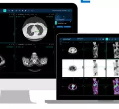 Radical Imaging's FlexView