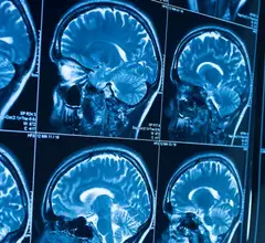 AI Imaging Contrast Development