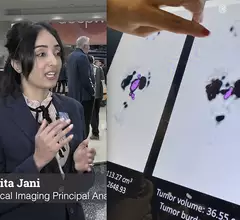 Bhvita Jani, medical imaging principal analyst, Signify Research, discusses growing trend of theragnostics in nuclear imaging and oncology at RSNA2023. #theragnostics #RSNA #RSNA23 #RSNA2023 #radiology #NucMed #Oncology