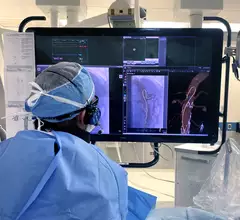 Philips LumiGuide 3D imaging system