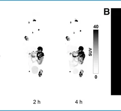 Whole-body maximum-intensity projections over time after [68Ga]Ga-DPI-4452 administration. 