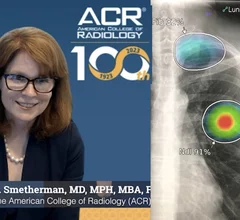 American College of Radiology (ACR) CEO Dana H. Smetherman, MD, MPH, MBA, FACR, explains why opportunistic screening is an important AI imaging technology trend radiology practices should be paying attention. 