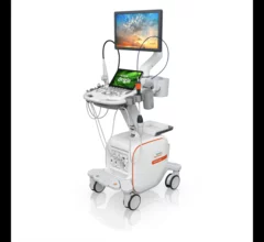 Siemens Healthineers has gained U.S. Food and Drug Administration (FDA) clearance for Acuson Origin, its new cardiovascular ultrasound system featuring advanced artificial intelligence (AI) capabilities. The Acuson Origin represents a significant update from the prior Siemens Healthineers cardiovascular ultrasound system, the Acuson SC2000.