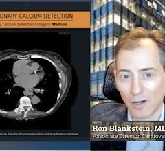 Ron Blankstein, MD, Brigham and Womens Hospital, explains a study using AI opportunistic screening in non-cardiac CT scans looking for coronary artery disease.