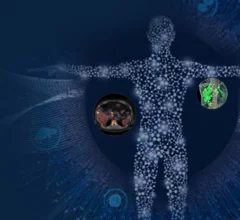 Theranostics GE HealthCAre