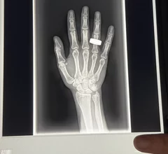 Chun Wang shares first medical radiographs captured in space.