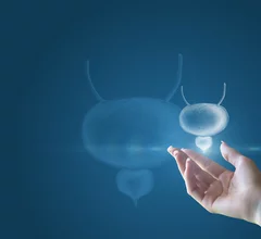 prostate PSMA