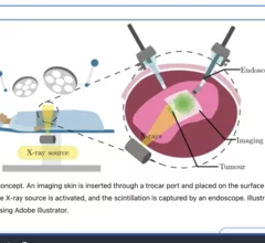 "Imaging skins" could improve surgical removal of cancerous tumors.