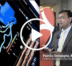 Partho Sengupta, MD, DM, FACC, FASE, Henry Rutgers Professor of Cardiology and Chief of Cardiovascular Medicine, at Robert Wood Johnson Medical School, and Chief of the Cardiovascular Service Line at Robert Wood Johnson University Hospital, offers an overview of the current state of artificial intelligence (AI) in cardiology. He offers insights from what he has seen from some of the more than 160 FDA-cleared algorithms specific to cardiovascular medicine and what is in development. #healthAI
