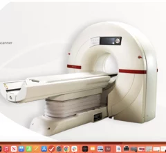 CT scanner screens for cardiovascular disease and lung cancer with single image.