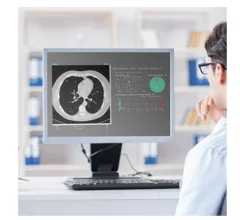 FDA clears algorithm that detects and quantifies incidental lung nodules
