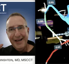 Ronen Rubinshtein, MD, FACC, FESC, director, heart institute, Edith Wolfson Medical Center, in Holon, Israel, president elect for the Society of Cardiovascular Computed Tomography (SCCT), and chairman of the SCCT 2026 annual scientific meeting, explains plaque imaging, AI and structural heart disease are the spotlight at the meeting.