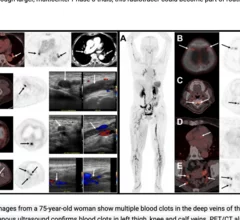 SNMMI Image of the Year2026