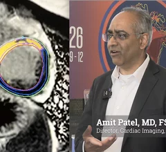 Amit Patel, MD, FSCCT, secretary of the Society for Cardiovascular Magnetic Resonance (SCMR), director of cardiac imaging and professor of medicine at the University of Virginia Health System in Charlottesville, outlined four key areas where cardiac MRI is expanding its clinical value, along with the growing role of artificial intelligence (AI) in making advanced imaging techniques more practical for routine clinical use. #CMR #SCMR #CardiacMR
