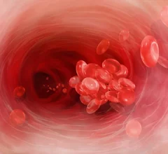 Vein.jpg Thumbnail