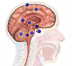 BrainSpots.JPG Thumbnail