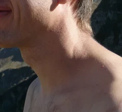 Neck.jpg Thumbnail