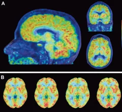 PETbrain.JPG Thumbnail