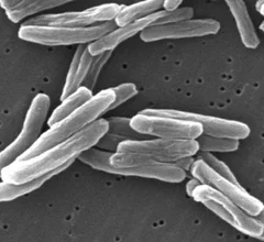 TBmicrobes.JPG Thumbnail