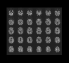 mri-magentom-prisma-research_000101-00275256~10.jpg Thumbnail