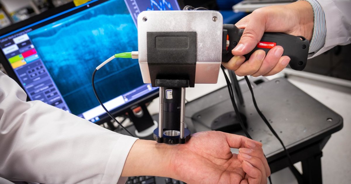 New ‘groundbreaking’ imaging device spots early cancers, beats MRI and ...