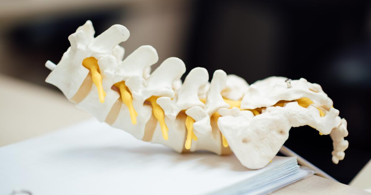 Artificial intelligence significantly reduces lumbar spine MRI interpretation times Artificial intelligence significantly reduces lumbar spine MRI interpretation times