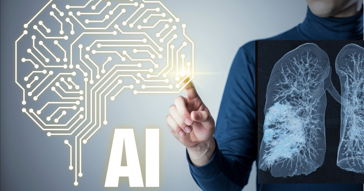 Artificial intelligence shows promise in mitigating radiologist bias