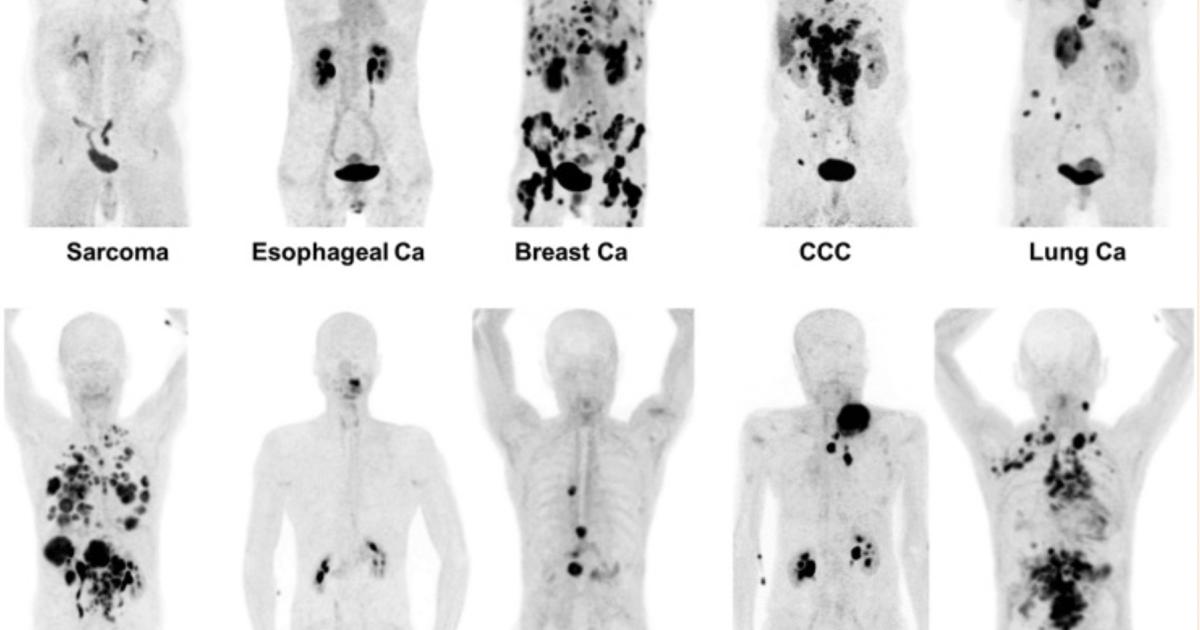 VIDEO: 6 key advances in molecular imaging technology for PET and SPECT
