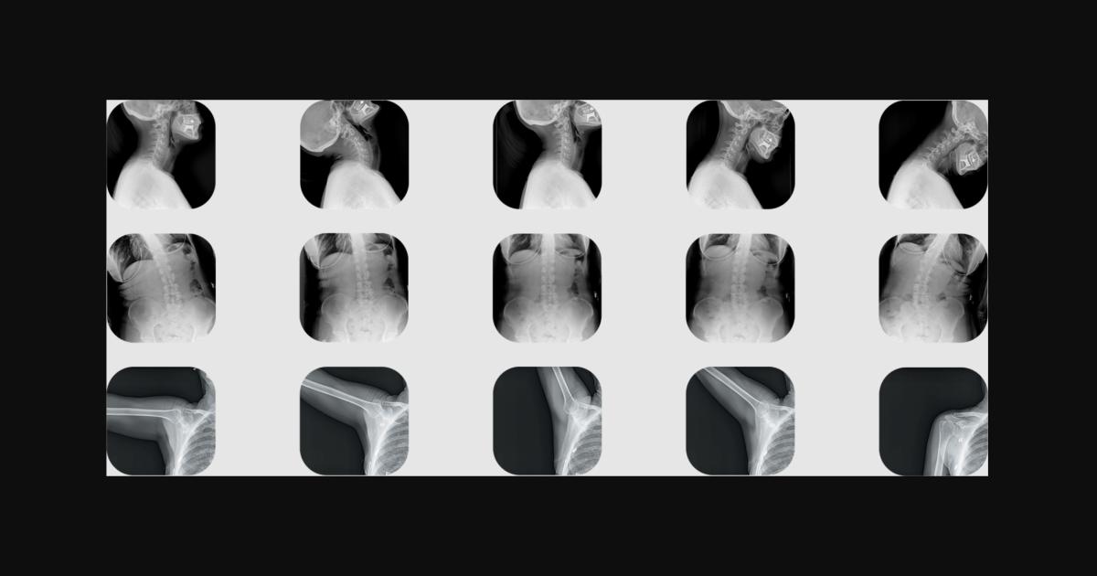 FDA clears X-ray system that produces hi-rez cine loops for chiropractors