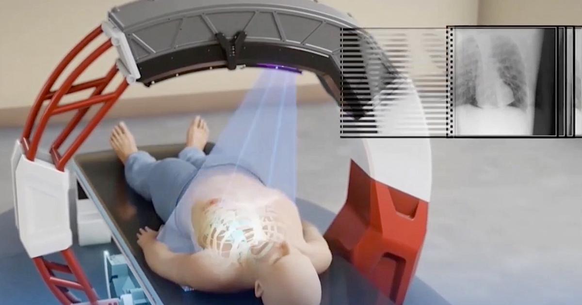 (新品未使用) Man　3DVD　RAYS Show Max 3DVD Rayscan Vision 16 3D Dental X-Ray | Voxel Dental