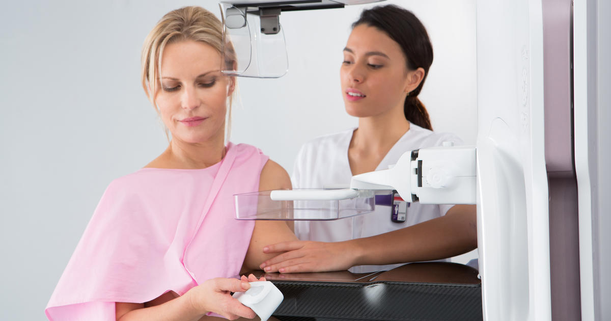 „Szturchnięcia” behawioralne znacząco zwiększają przestrzeganie regularnych badań przesiewowych mammograficznych