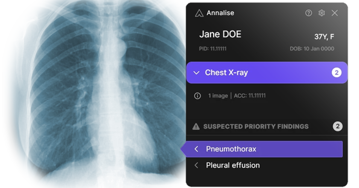 AI-assisted radiology and medical imaging analysis