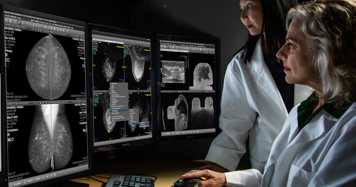 AI bolsters breast radiologists’ cancer detection rate, real world study finds