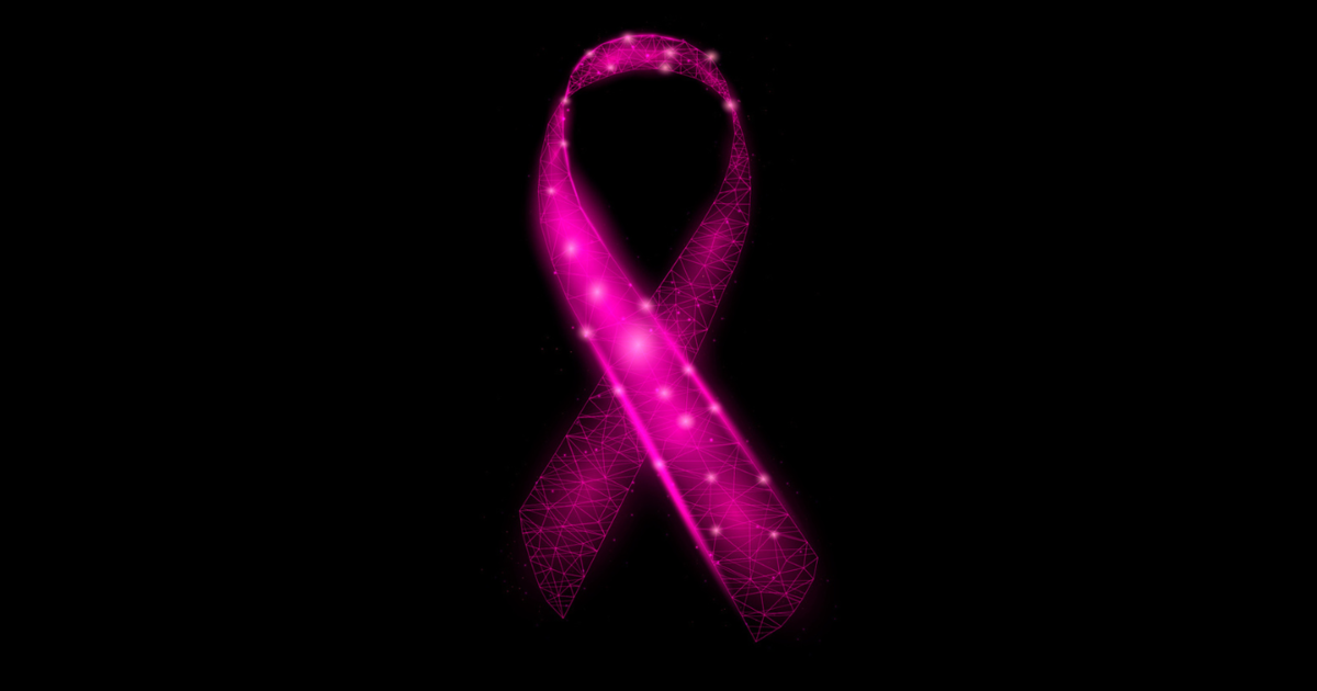 AI triage tool slashes breast cancer screening workloads by 77%