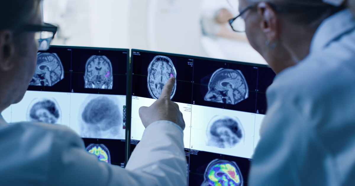 GE HealthCare finalizes acquisition of Cleveland-based provider of AI imaging-analysis software