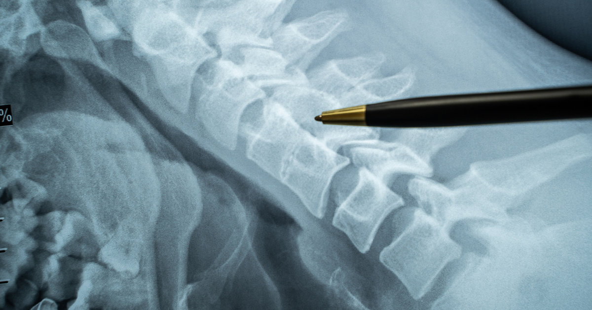 Jury reaches ‘record’ $60M verdict in case over botched interventional ...