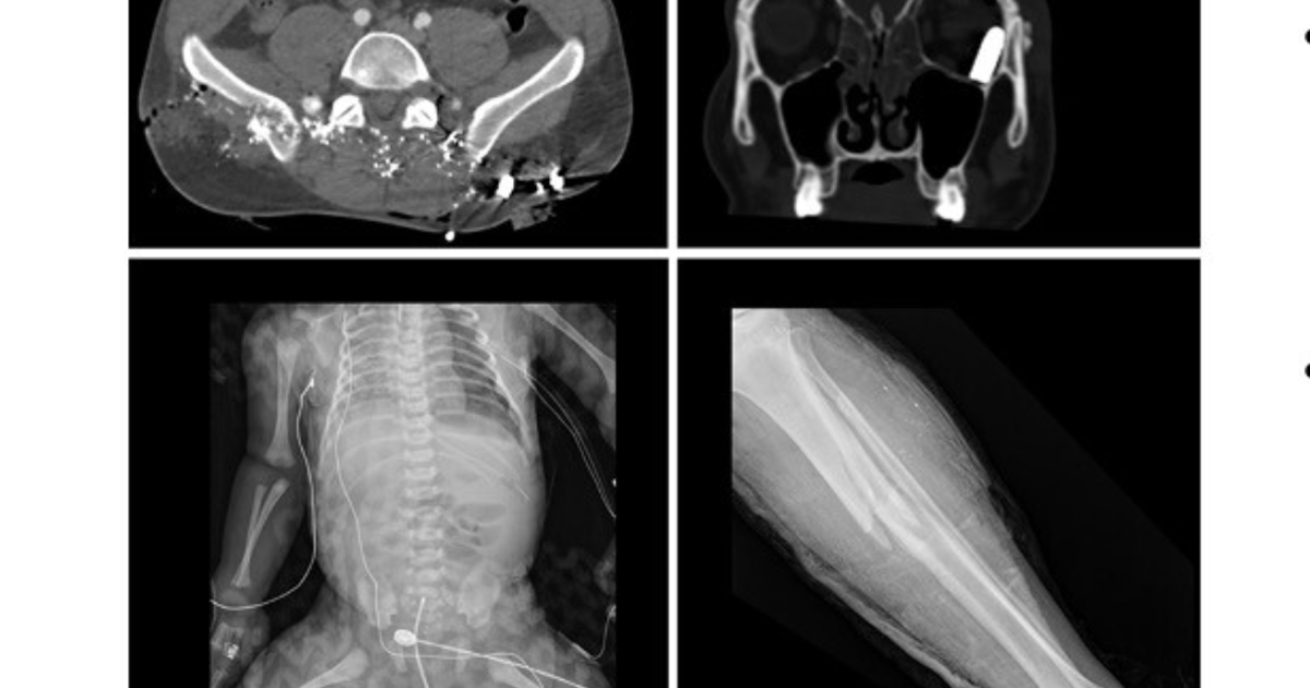 Radiology lessons learned from the 2023 terror attacks in Israel