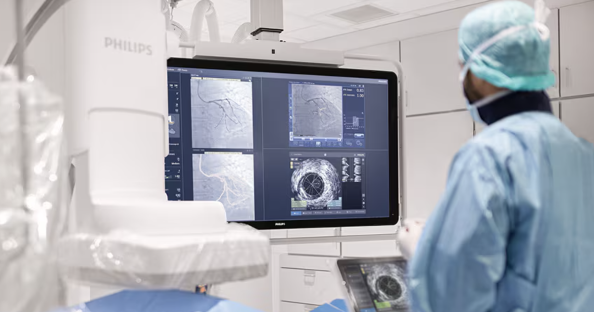 Philips to acquire company specializing in AI-powered intravascular imaging