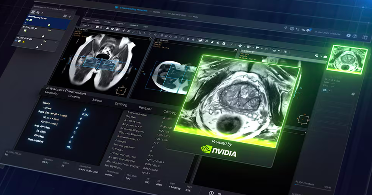 Philips-Nvidia team-up strives to create a ‘self-driving MRI’ machine